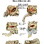 16. Kształt zastawki krętniczo-kątniczej - Shape of ileocecal valve