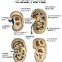 29. Przekroje czołowe nerki lewej - Frontal sections of left kidney