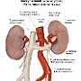 30. Naczynia nerek (widok od przodu) - Renal vessels (anterior view)