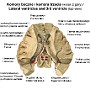 4. Komory boczne i komora trzecia (widok z góry) - Lateral ventricles and third ventricle (top view)