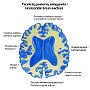 40. Przekrój poziomy mózgowia - Horizontal brain section