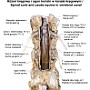42. Rdzeń kręgowy i ogon koński w kanale kręgowym - Spinal cord and cauda equina in vertebral canal